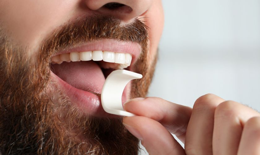 The Ultimate Guide to Finding the Best Dental Implants in Quincy: Tips and Recommendations - Cornerstone Dental Health