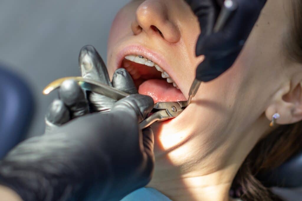 The Ultimate Guide to Finding the Best Dental Implants in Quincy: Tips and Recommendations - Cornerstone Dental Health